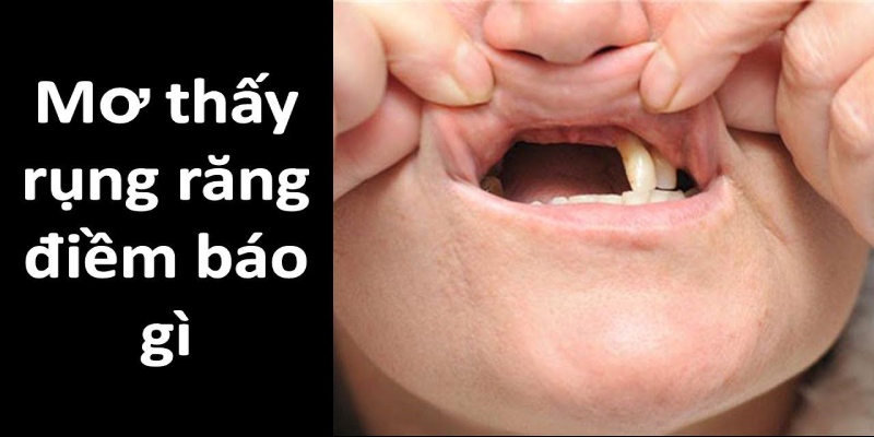 Điềm báo tốt hay xấu khi mơ thấy rụng răng?