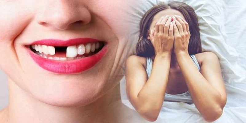 Giải mã về giấc chiêm bao rụng răng hàm trên