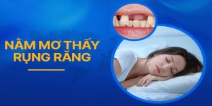 Nằm Mơ Thấy Rụng Răng Đánh Số May Trúng Giải Độc Đắc?